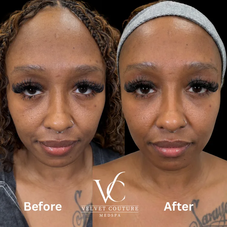 Facial balancing treatment result