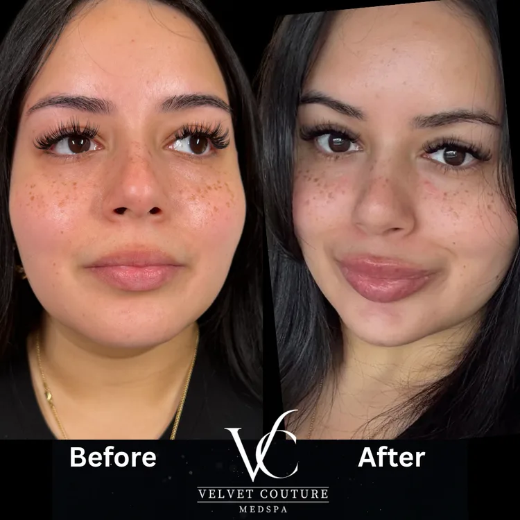 Glowing skin treatment result