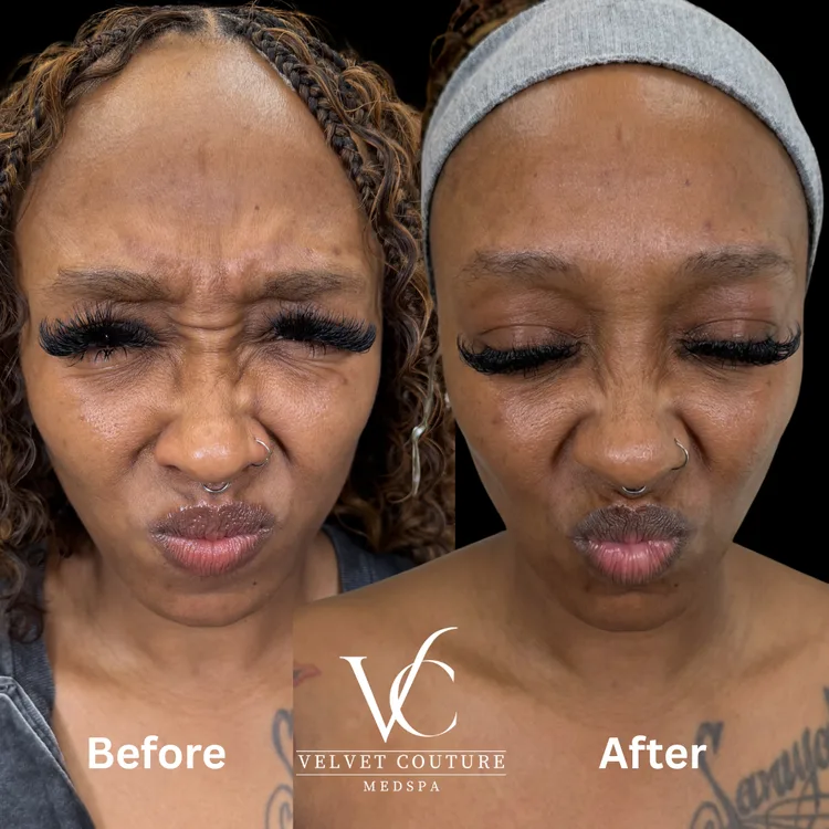 Facial Balancing & Filler at Velvet Couture Medspa in Houston Heights